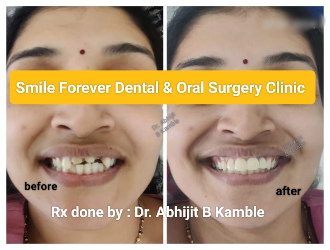 Dental Care
